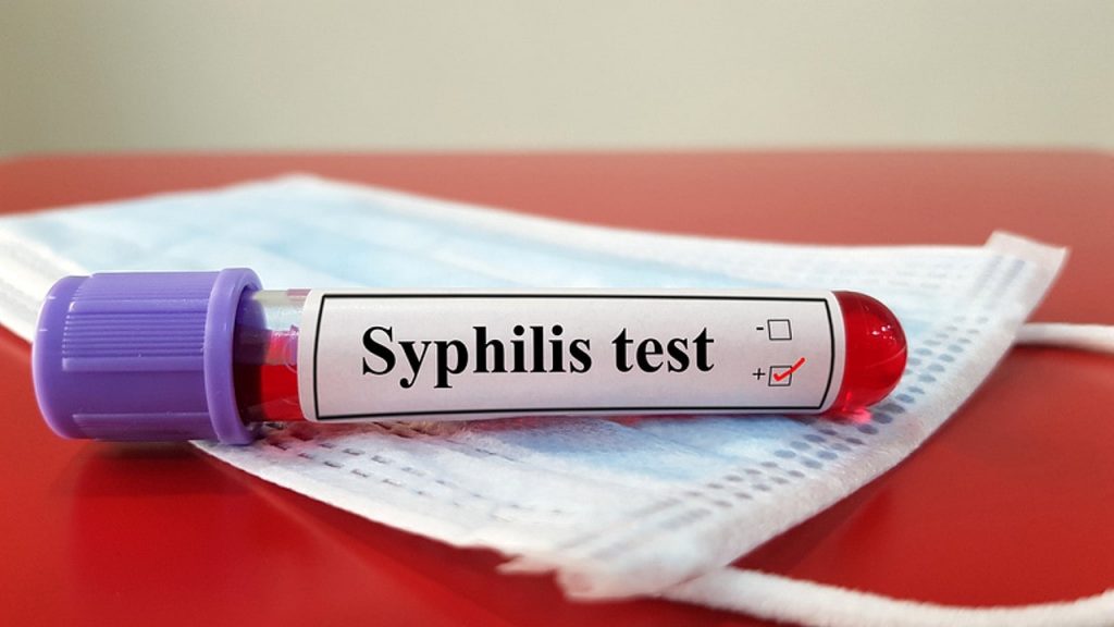 Test Thử Giang Mai Onsite Syphilis Ab Combo Rapid Test