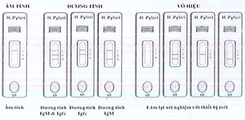 cach-doc-ket-qua-hp-igg/igm