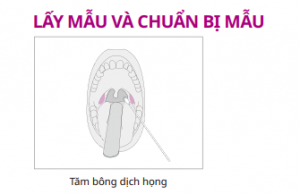 cach lay mau dich hong