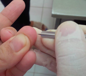 kim-lancet-lay-mau-mao-mạch