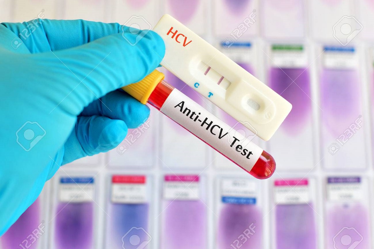 anti-hcv-test