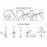 quy-trinh-xet-nghiem-test-thu-covid