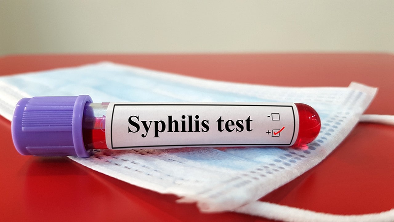 test-nhanh-syphilis2