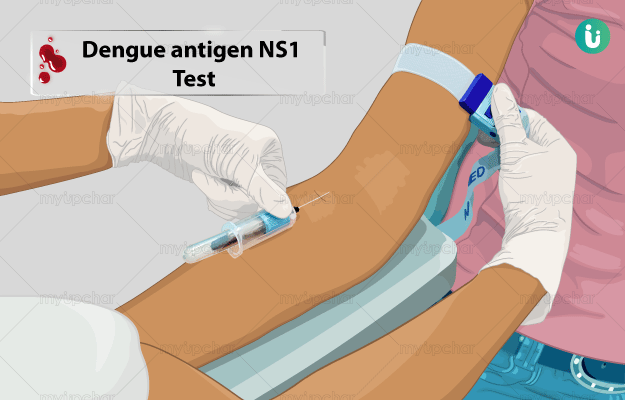 dengue-ns1