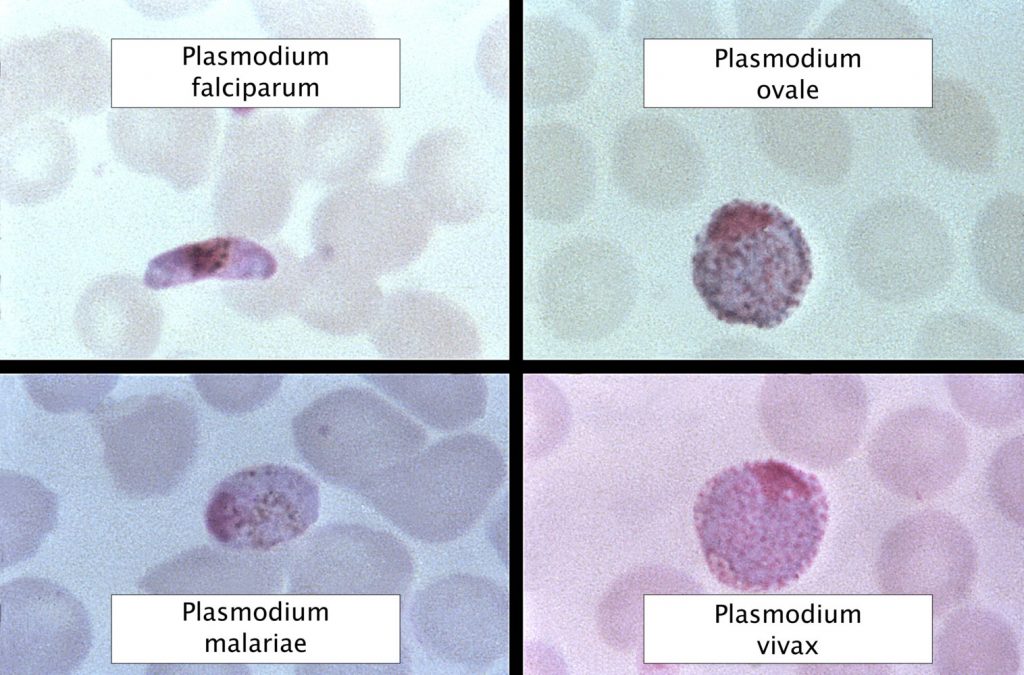 malaria-test 3